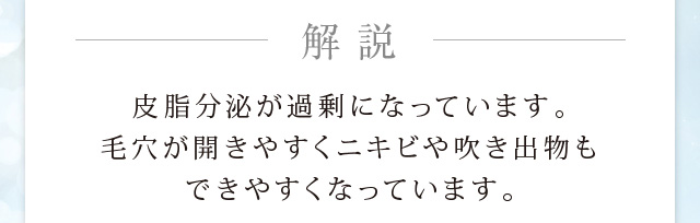 皮脂分泌が過剰になっています。毛穴が開きやすくニキビや吹き出物もできやすくなっています。