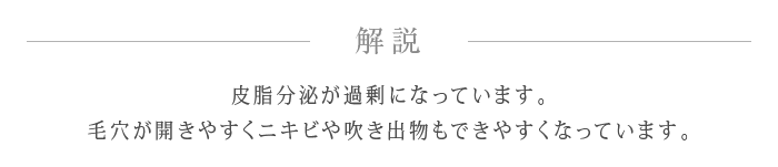 解説 皮脂分泌が過剰になっています。毛穴が開きやすくニキビや吹き出物もできやすくなっています。