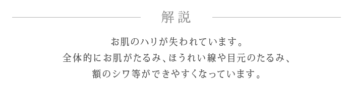 解説 お肌のハリが失われています。
全体的にお肌がたるみ、ほうれい線や目元のたるみ、額のシワ等ができやすくなっています。